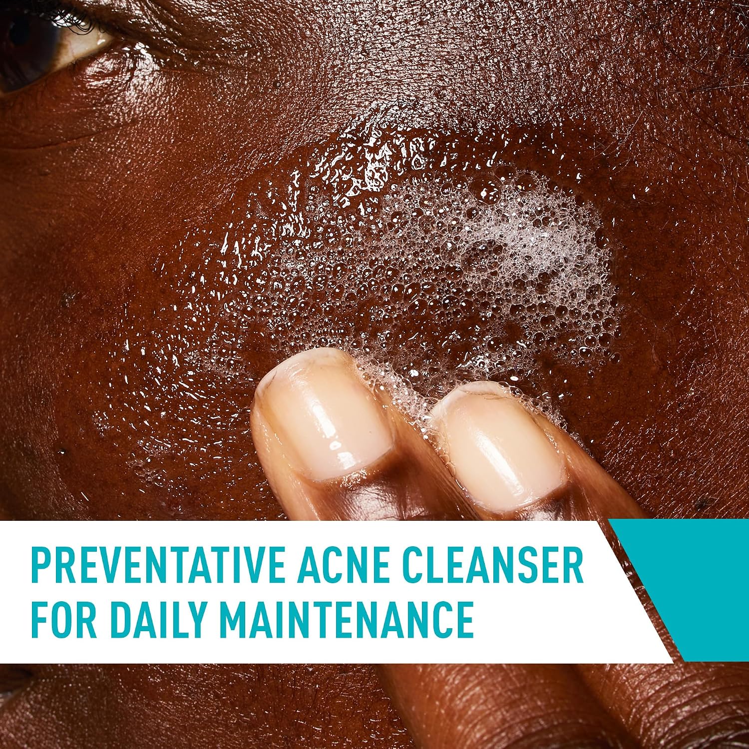 CeraVe Acne Control Cleanser. Face Wash with 2% Salicylic Acid. 16 oz | Skin Care with Niacinamide. Acne Face Wash. Acne Treatment For Face. Ceramides. Fragrance Free. Gentle. Oil Absorbing Clay