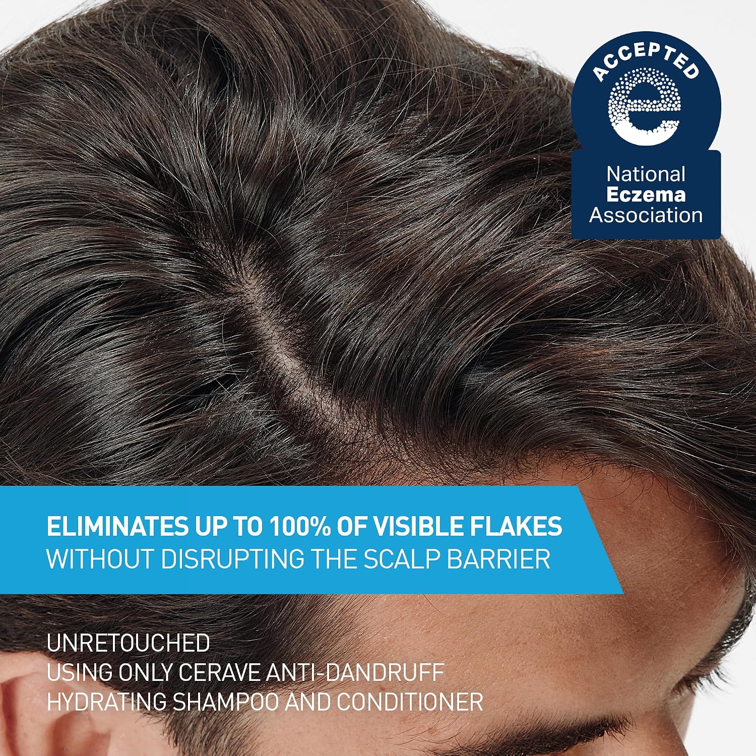 CeraVe Hydrating Anti Dandruff Conditioner with Hyaluronic Acid. 9oz | 0.5% Pyrithione Zinc Dandruff Treatment with Niacinamide That Helps Eliminate Flakes and Reduce Itchy Scalp. Sulfate-Free