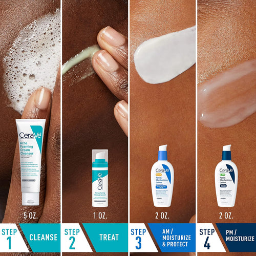 CeraVe Acne Skin Care Set. Foaming Cleanser + Retinol Serum + AM&PM Lotion | 5oz Acne Foaming Cream Cleanser + 1oz Resurfacing Retinol Serum + 2oz AM SPF 30 Lotion + 2oz PM Facial Moisturizing Lotion